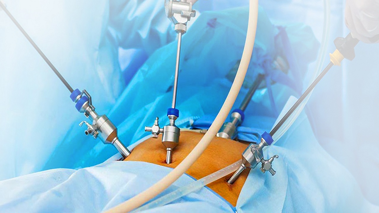 general and laparoscopic surgery